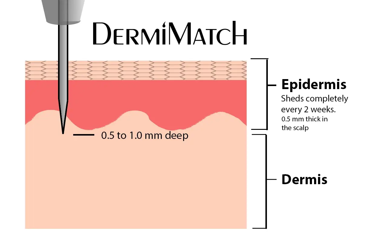 3-Pack HD Scalp Pigments by DermMicro (SMP ink) - Image 4