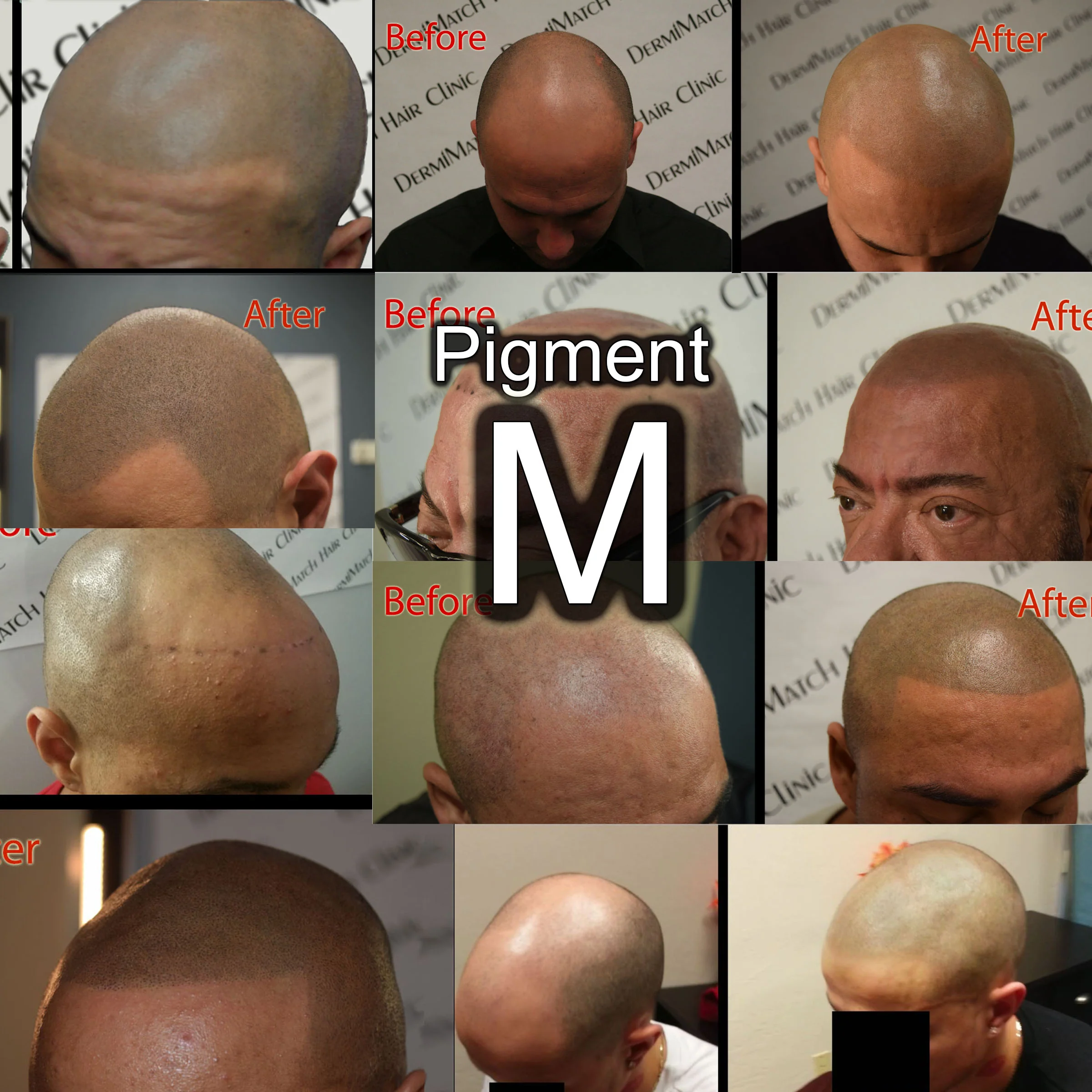 DermMicro HD Pigments (SMP ink) - Image 3