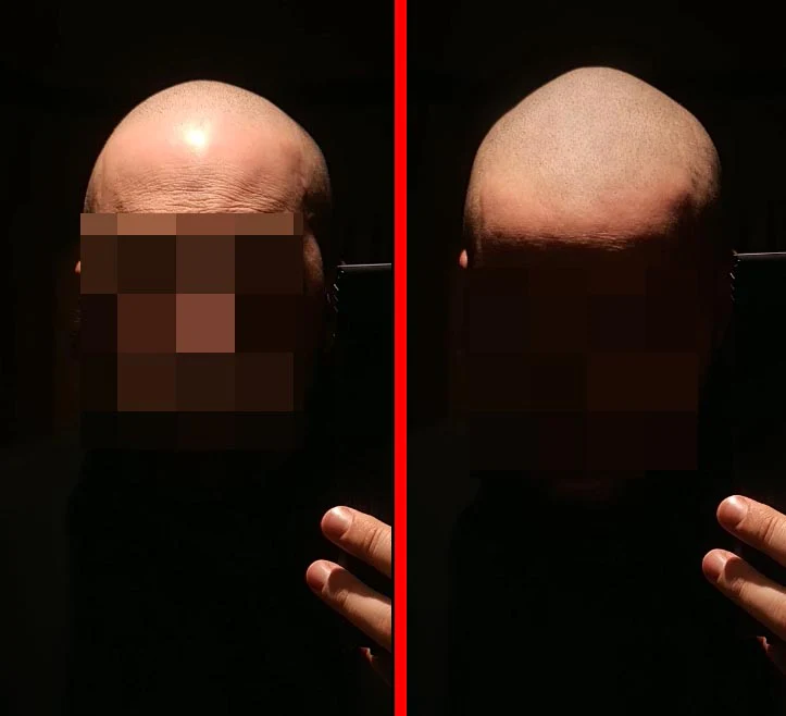 Zero Shine 2.0 by DermMicro for matte or mattifying effect on scalp after SMP Scalp Micropigmentation - Image 2